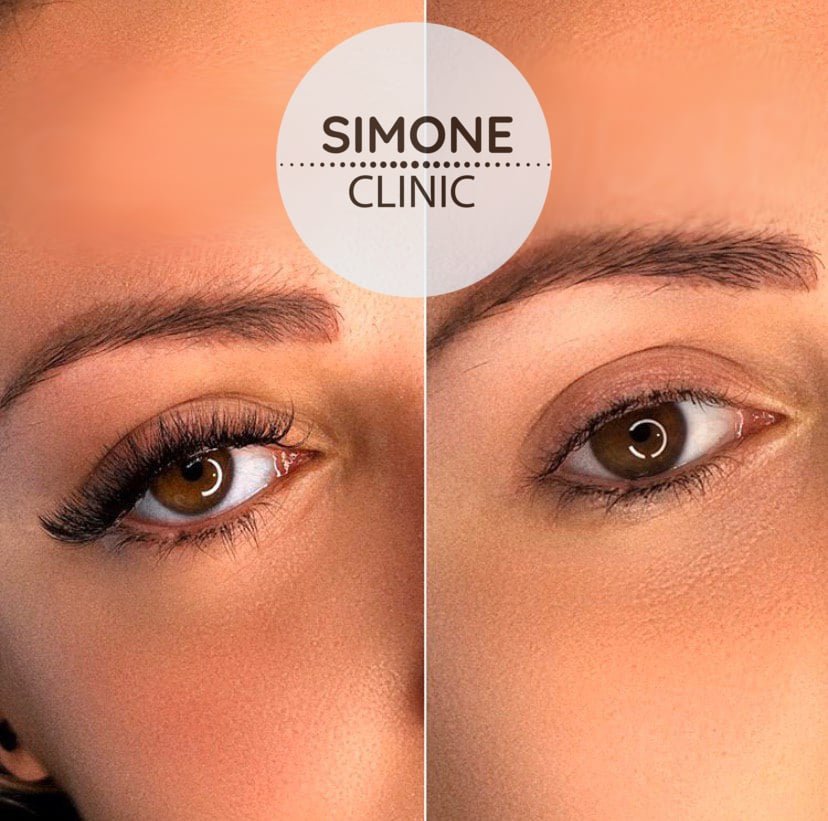 Classic Individual Eyelash Extensions | Simone Clinic