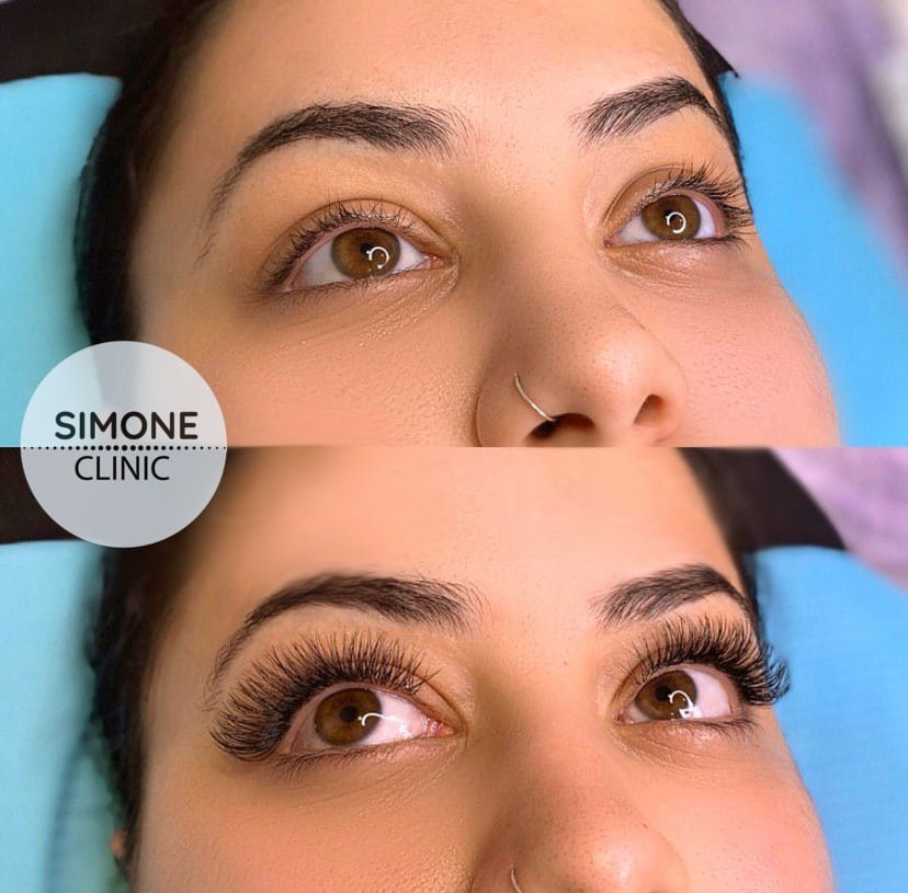 Eyelash Extensions - Simone Clinic